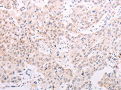 TYR Antibody