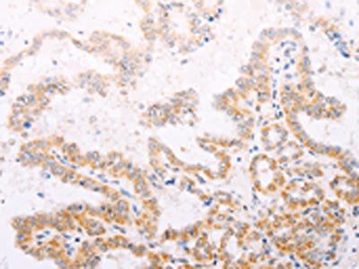 TYR Antibody