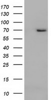 TYRO3 Antibody
