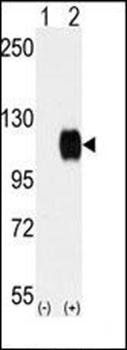 TYRO3 antibody
