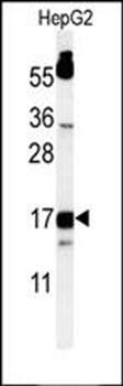 TYROBP antibody