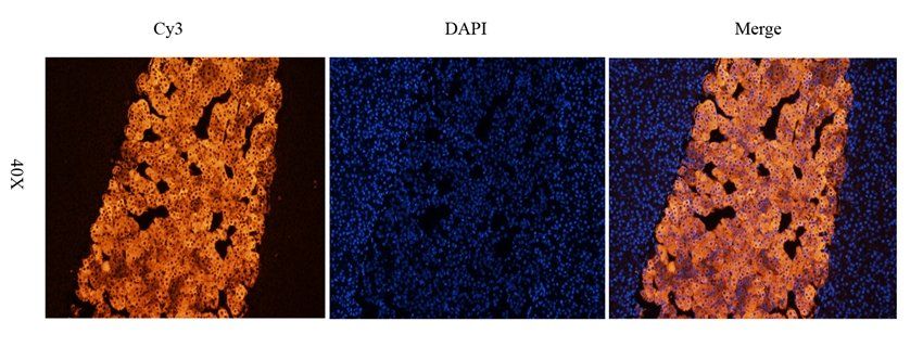 Tyrosine Hydroxylase antibody