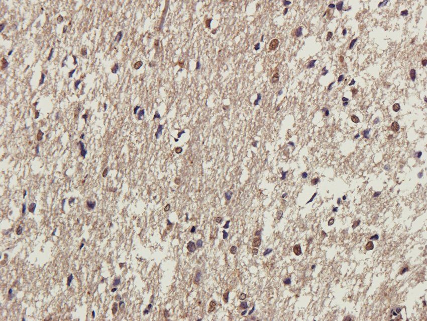 Tyrosine Hydroxylase antibody