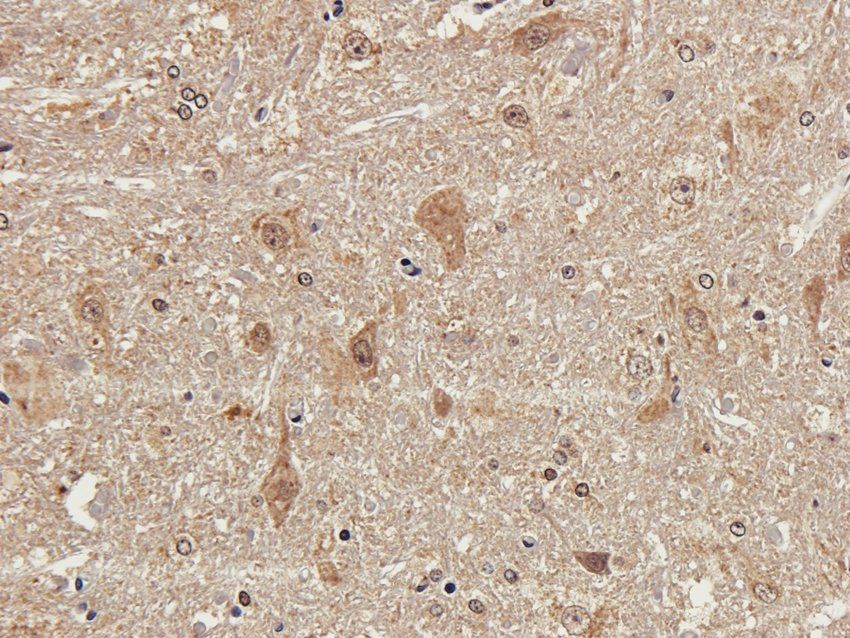 Tyrosine Hydroxylase antibody