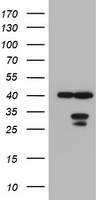 Tyrosine Hydroxylase Antibody