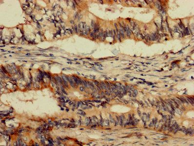 ABL1 Antibody
