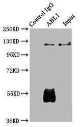 ABL1 Antibody