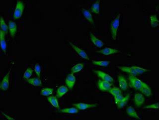 Tyrosine-protein kinase Lck antibody