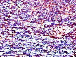 LCK Antibody