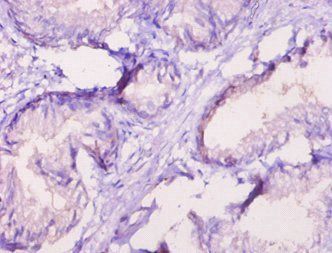 ROR1 Antibody