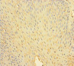 Tyrosine-protein phosphatase non-R type 6 antibody