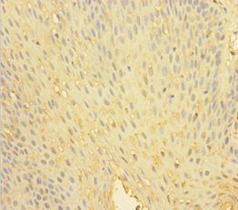 PTPN6 Antibody