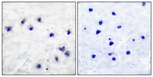 Tyrosine Hydroxylase (Phospho-Ser19) Antibody