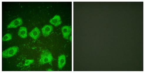 Tyrosine Hydroxylase (Ab-19) Antibody
