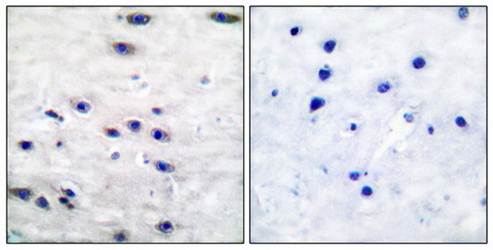 Tyrosine Hydroxylase (Ab-19) Antibody