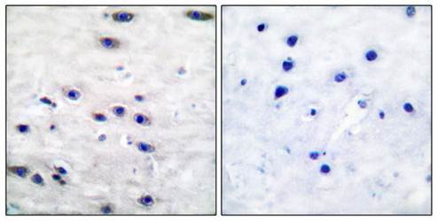 Tyrosine Hydroxylase antibody