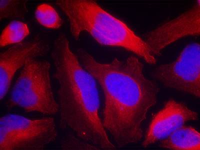 Tyrosine Hydroxylase (Phospho-Ser19) Antibody