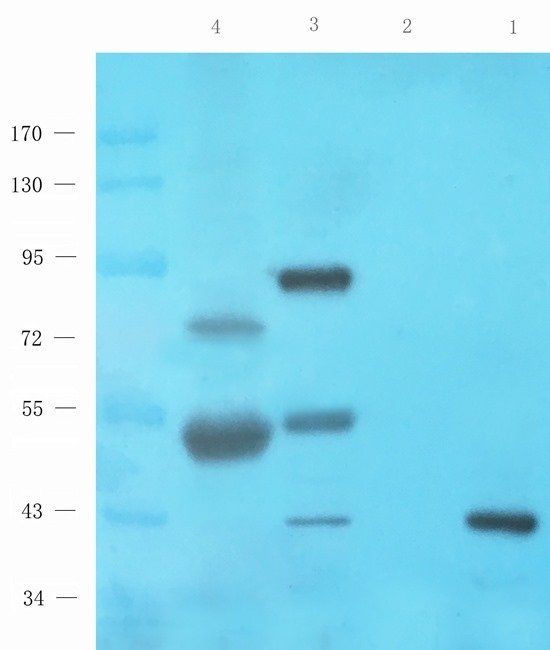 TYRP1 antibody