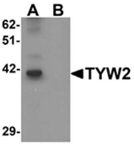TYW2 Rabbit Polyclonal Antibody