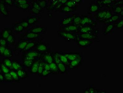 U1 small nuclear ribonucleoprotein A antibody