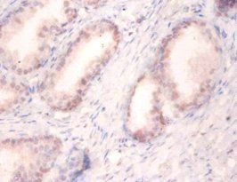 SNRPA Antibody