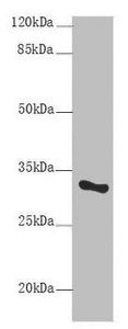 U1 small nuclear ribonucleoprotein A antibody