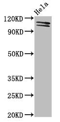 UBA1 antibody