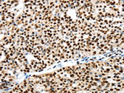 UBA1 Antibody