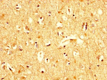 UBA52 Antibody