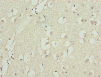 UBA6 Antibody