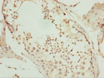UBA6 Antibody