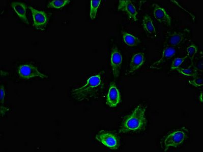 UBA6 Antibody