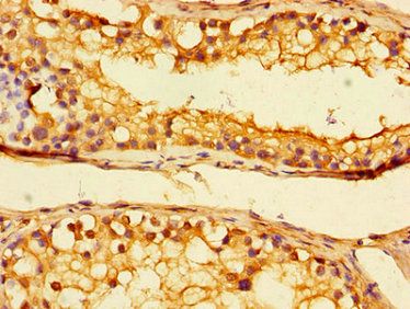 UBA6 Antibody
