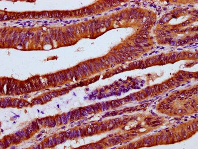 UBAC2 Antibody
