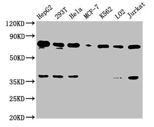 UBC Antibody