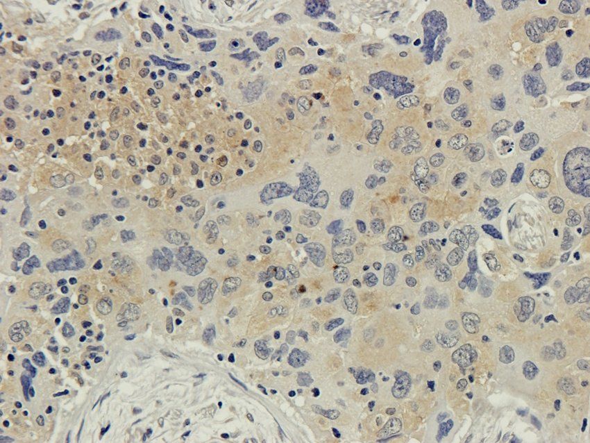 UBC12 antibody