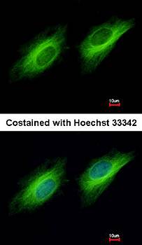 UBE1 antibody