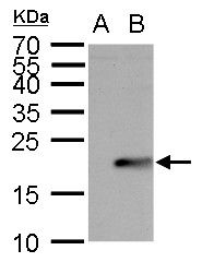ubiquitin conjugating enzyme E2 B Antibody