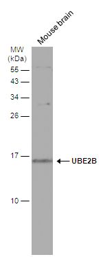 ubiquitin conjugating enzyme E2 B Antibody