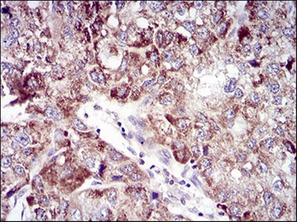 UBE2C Antibody