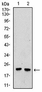 UBE2C Antibody