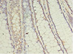 UBE2C Antibody