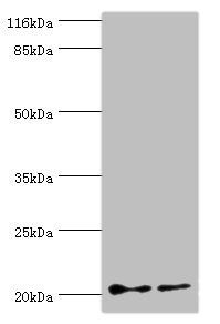 UBE2C Antibody