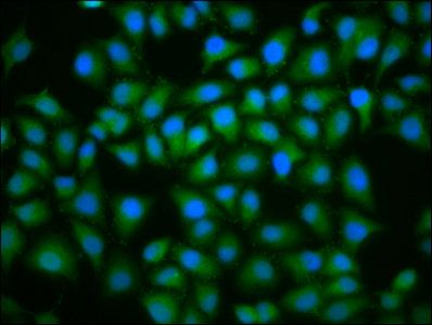 UBE2D2 Antibody