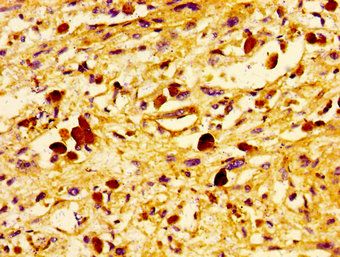UBE2D2 Antibody