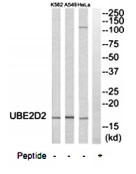 UBE2D2 Antibody