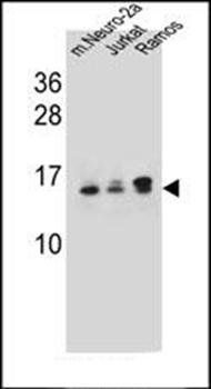 UBE2E2 antibody