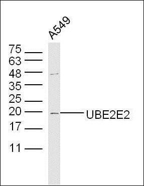 UBE2E2 antibody