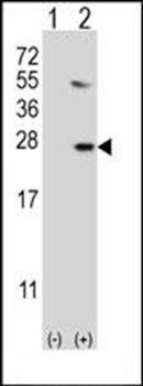 UBE2G1 antibody