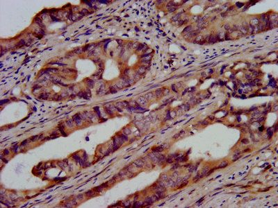 UBE2G1 Antibody